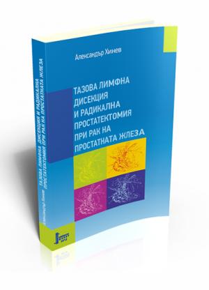 Тазова лимфна дисекция и радикална простатектомия при рак на простатната жлеза